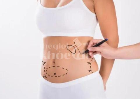 Hút Mỡ Toàn Thân – Đấu Giá Slot Giá Sốc tại Thegioikhoedep.com