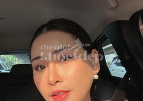 Căng chỉ nâng cơ sau 35 tuổi – Giải pháp trẻ hóa, níu giữ thanh xuân - 2/4