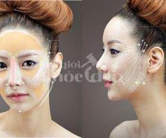 Căng chỉ nâng cơ hay phẫu thuật căng da mặt – Nên chọn giải pháp nào?