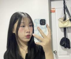 Nâng mũi S-line tự nhiên chuẩn Y khoa – Đẹp thanh thoát, mềm mại bền lâu