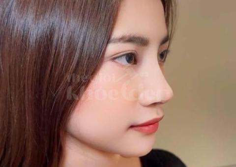 Dịch Vụ Nâng Mũi Đẹp An Toàn – Bác Sĩ Chuyên Khoa Tư Vấn, Cam Kết Hiệu Quả - 6/6