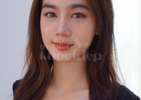 Dịch vụ nâng mũi cấu trúc 4D – An toàn, đẹp tự nhiên, duy trì lâu dài - 3/4