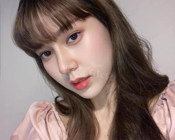 Nâng mũi S-line – Dáng mũi tự nhiên, thon gọn, thanh thoát gương mặt - 4/4