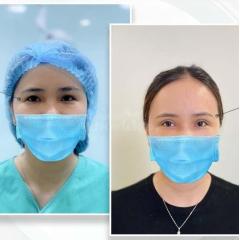 Cắt mí Eyelid Design Hàn Quốc – Công nghệ mí tự nhiên, đẹp bền lâu