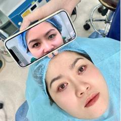 Cắt mí Hàn Quốc công nghệ mới – Khắc phục mắt 1 mí, sụp mí, da chùng, cho ánh nhìn rạng ngời tự nhiê