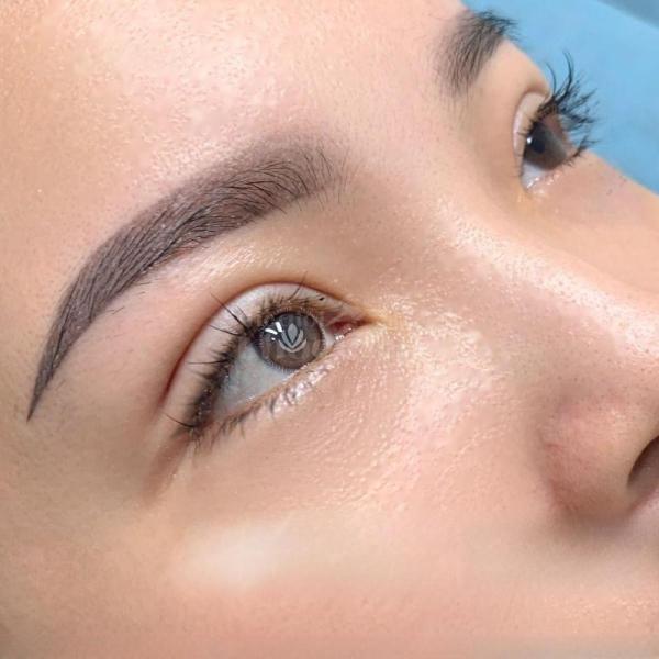 Cắt mí Mini Deep – Tạo đôi mắt hai mí sâu tự nhiên, đẹp bền lâu - 1/5