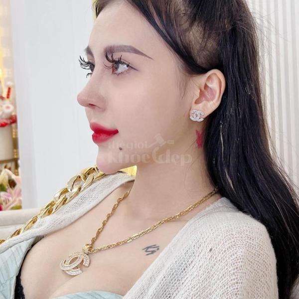 Nâng mũi S-Line 4D – Dáng mũi cao thanh thoát, chuẩn tỷ lệ vàng gương mặt - 2/5