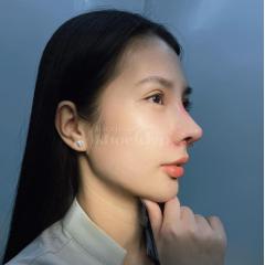 Phẫu thuật nâng mũi đẹp – Giải pháp chuẩn cho gương mặt thanh tú, sang trọng