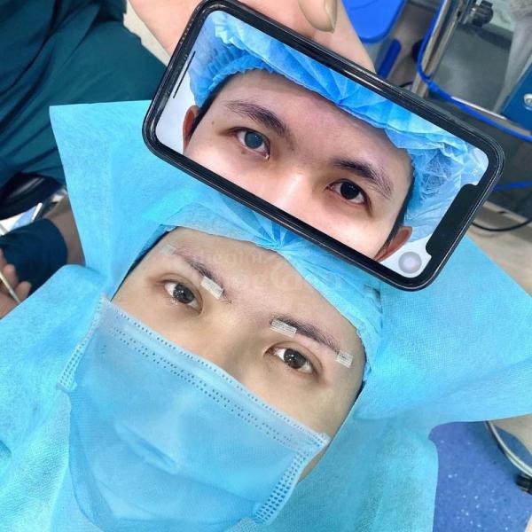 Nhấn mí Mini Deep 2026 – Bí quyết đôi mắt to tròn, trẻ trung tự nhiên - 1/3