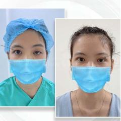 Cắt mí 2 mí & Nhấn mí Mini Deep – Trẻ hóa ánh mắt tự nhiên, an toàn