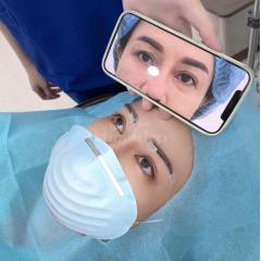 Cắt mí – Nhấn mí Mini Deep: Đôi mắt 2 mí đẹp tự nhiên, trẻ trung