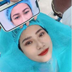 Combo Cắt mí + Lấy mỡ mắt dưới – Giải pháp trẻ hóa mắt toàn diện, tự nhiên, duy trì lâu dài